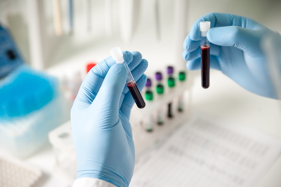blood test tubes