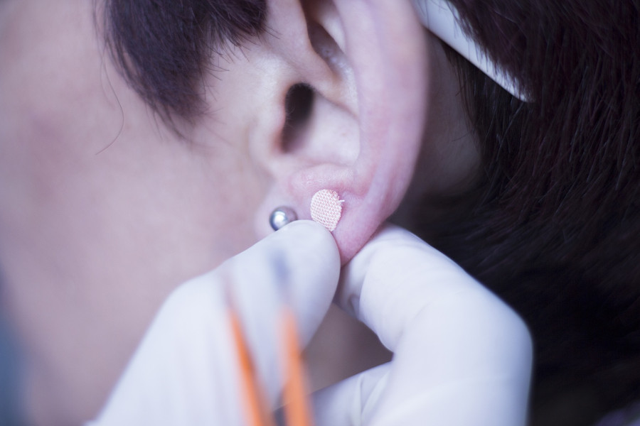 Auriculartherapy Ear Seed Treatment
