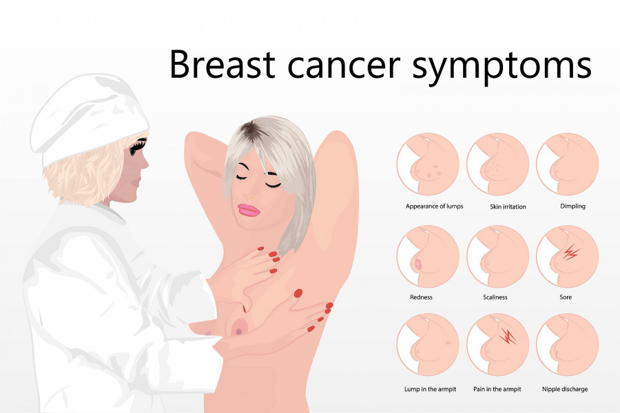 Breast Cancer Symptoms