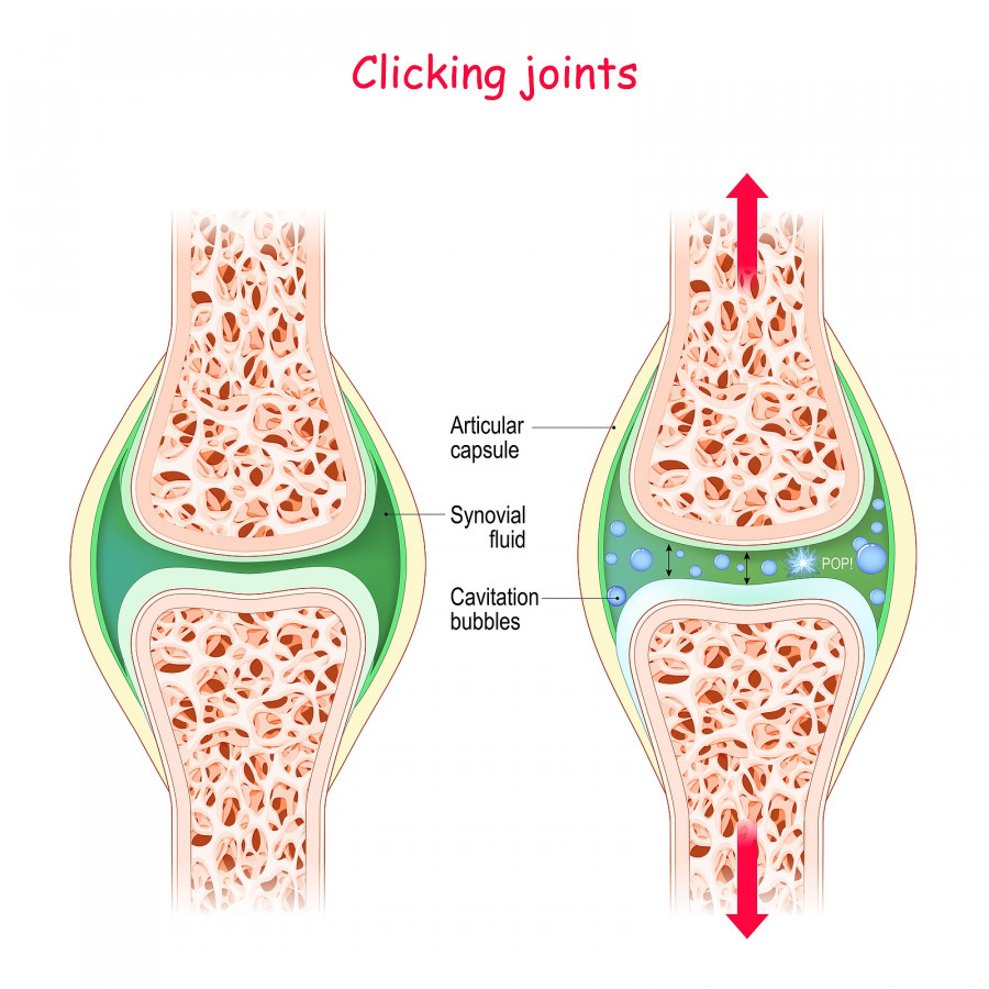 Joints And Popping Sound. Physiological Mechanism Of Cavitation.