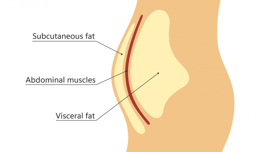 Visceral And Subcutaneous Fat Around Waistline