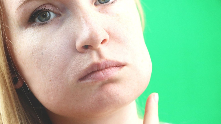 Πρήξιμο - οίδημα 