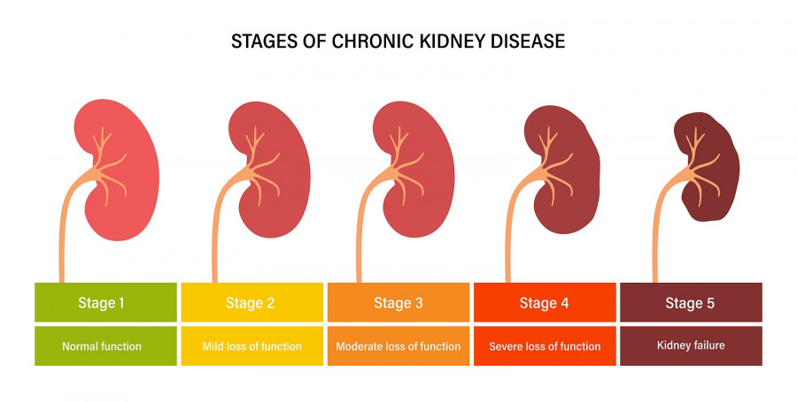 Kidney Disease