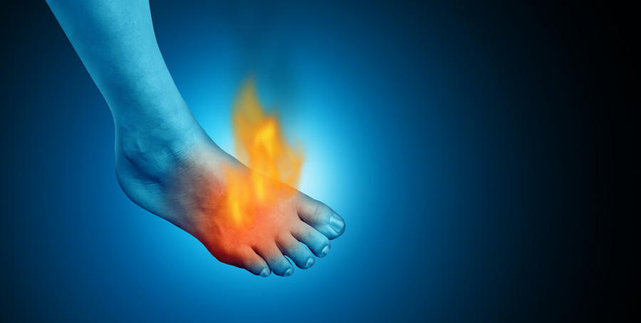 Painful Foot And Feet Pain As A Podiatry Symbol For Painful  inflammation 