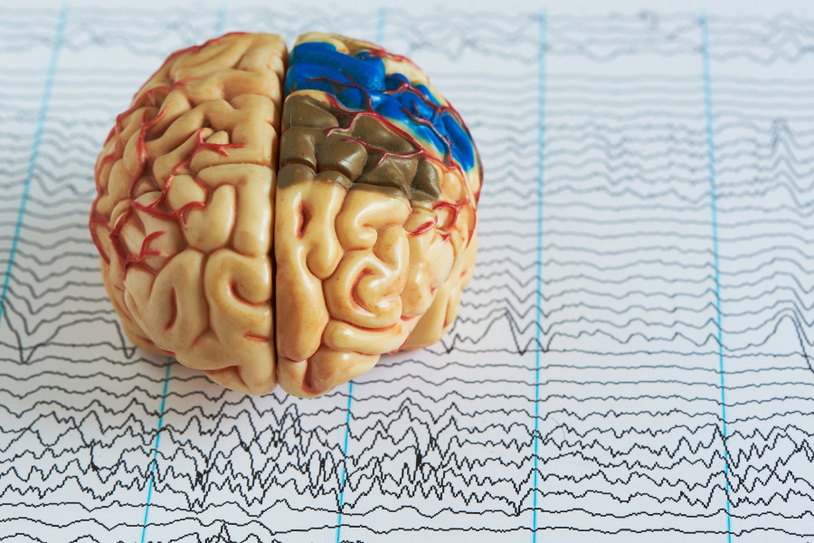 Human Brain Model On Background Of Brain Waves