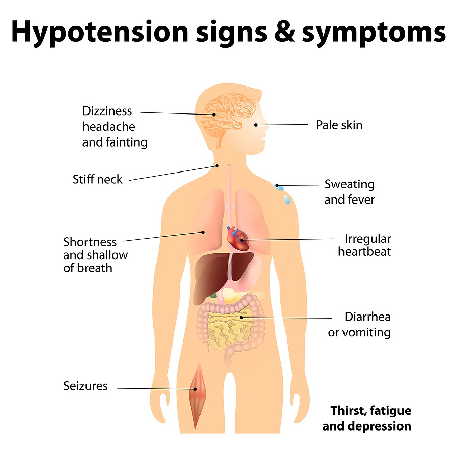 Hypotension Signs & Symptoms