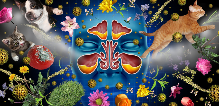 Allergic Sinusitis Illness As A Nasal Cavity Blockage Disease