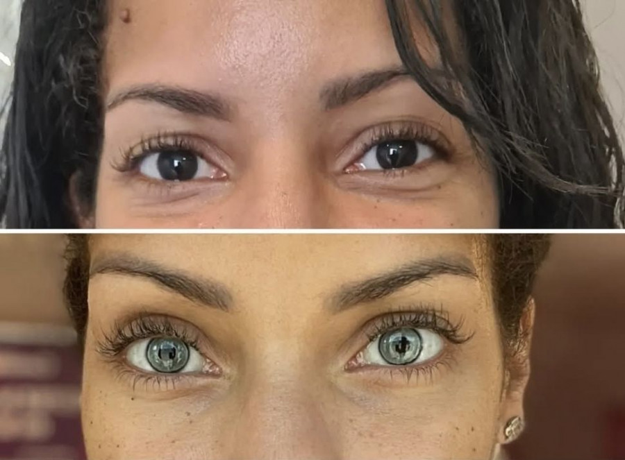 Μέθοδος FLAAK