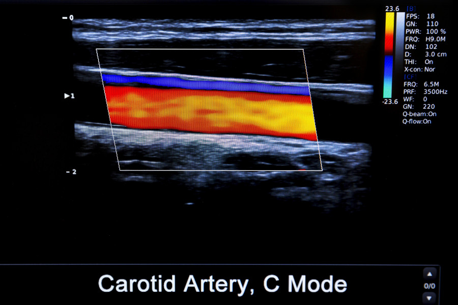 Colourful Image Of Modern Ultrasound Monitor