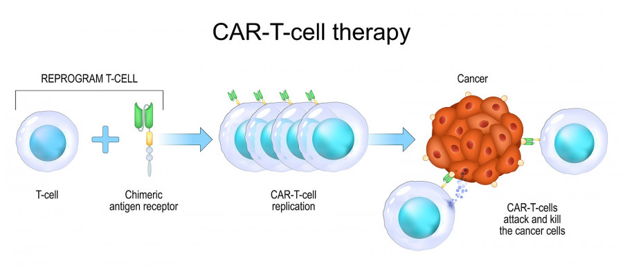 Car T-cell Therapy. Cancer Immunotherapy. Killing Of Tumor Cells