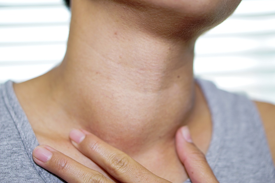 Abnormal Enlargement Of Thyroid gland Hyperthyroidism (overactive thyroid) at the throat