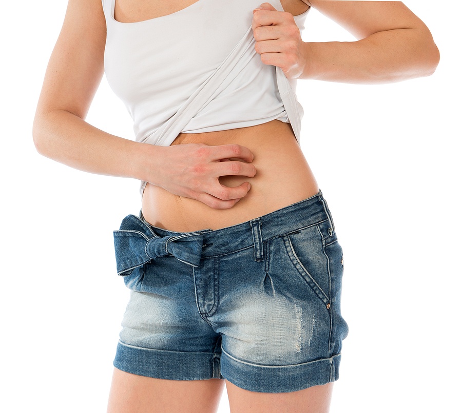 Woman Allergy Scratching Her Abdomen Stomach With Fingers