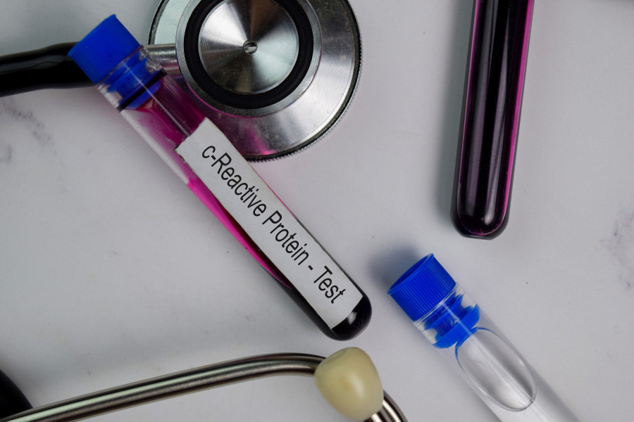 C-reactive Protein - Test With Blood Sample