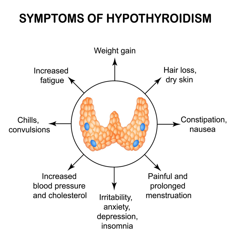 Symptoms of hypothyroidism