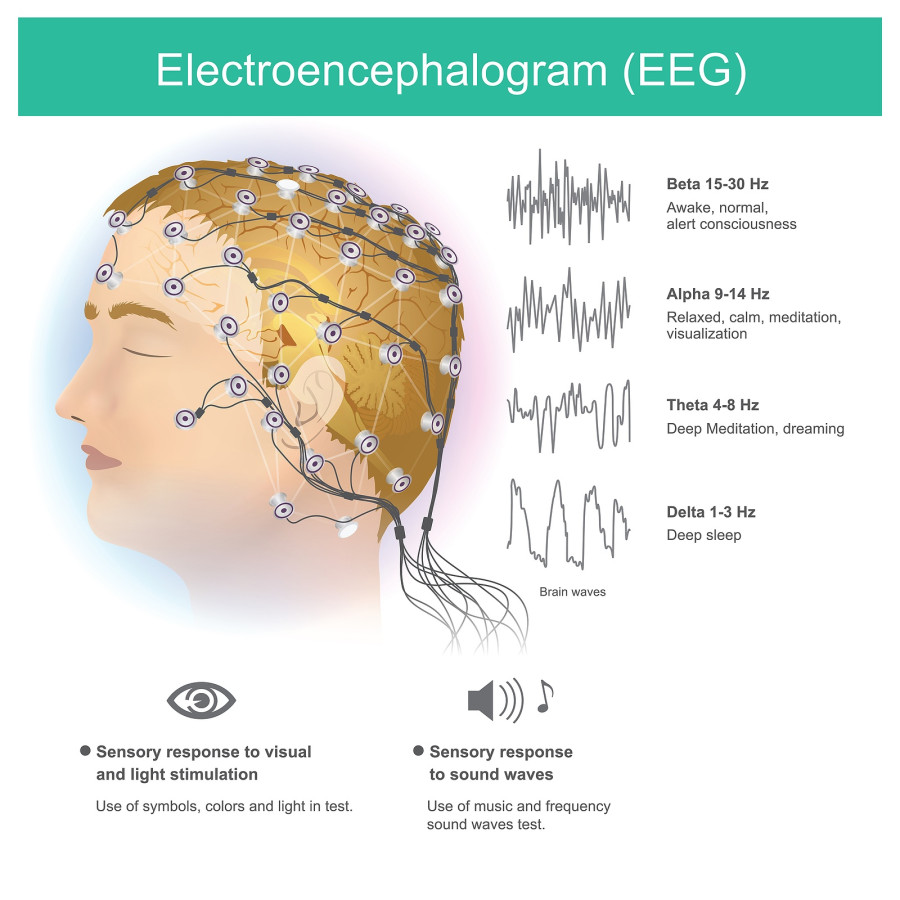 The Use Of Electrodes To Read Small Electromagnetic Waves
