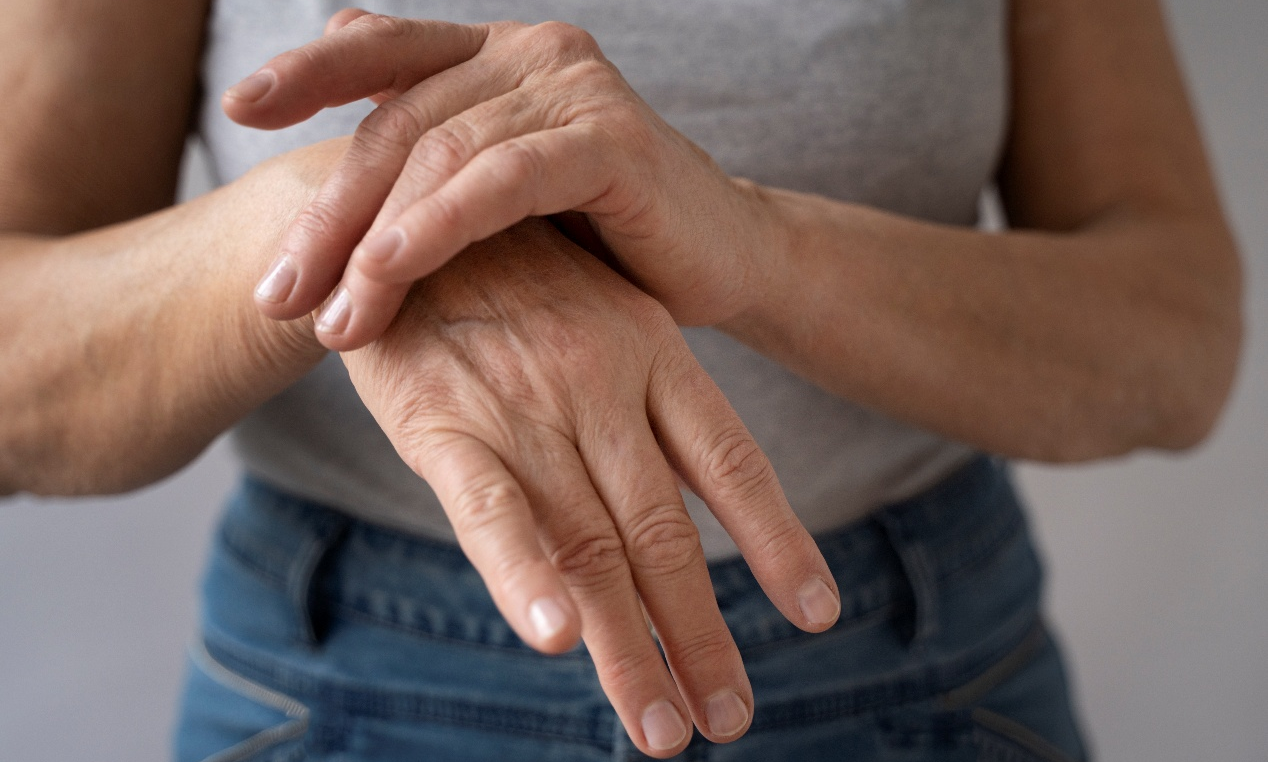 Ψωρίαση: Όλα όσα πρέπει να γνωρίζετε
